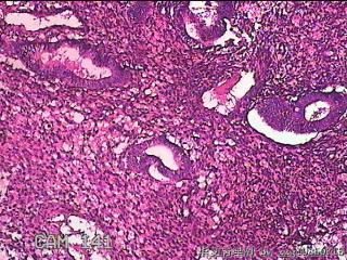 子宫内膜组织图32
