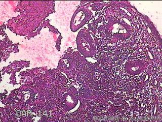 子宫内膜组织图27