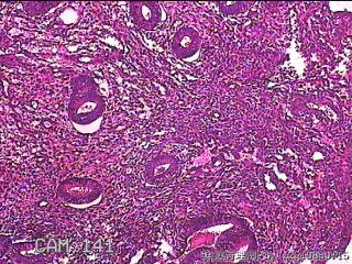 子宫内膜组织图23