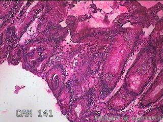 胃窦大弯侧粘膜图31