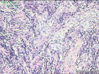 食管活检组织，请教请教？图7