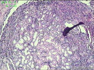 食管活检组织，请教请教？图2