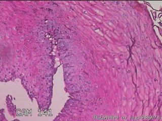 下段食管粘膜图15