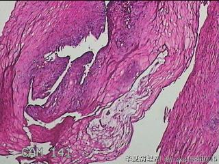 下段食管粘膜图5