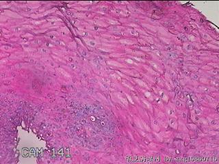 下段食管粘膜图18