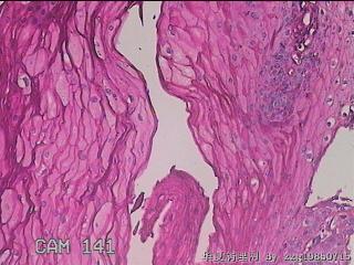 下段食管粘膜图10