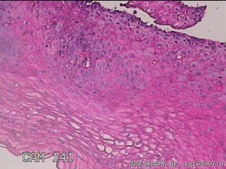 下段食管粘膜图17