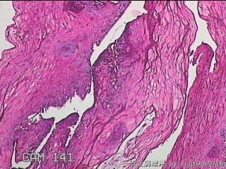 下段食管粘膜图4
