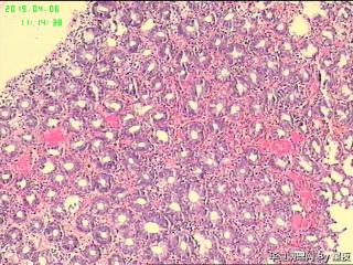 结肠活检组织，请教？图2