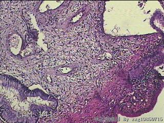 宫颈组织图3
