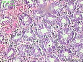 结肠活检组织，请教？图8