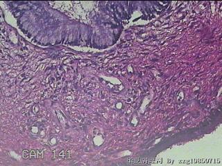 宫颈组织图31