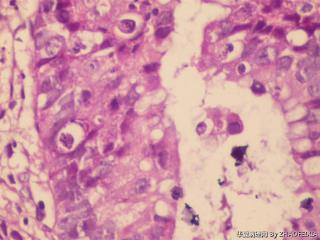 直肠活检组织图9
