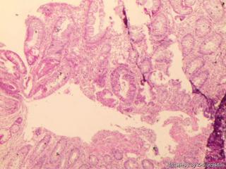 直肠活检组织图2