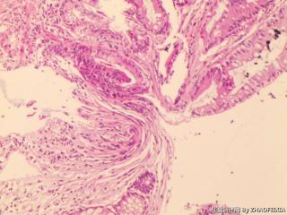 直肠活检组织图5