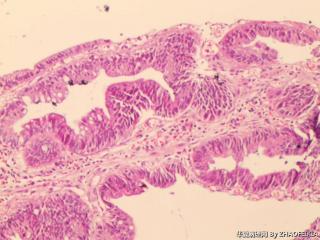 直肠组织图6