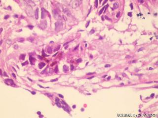 直肠活检组织图7