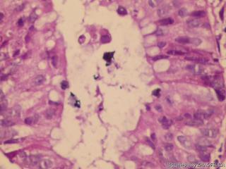 直肠活检组织图10