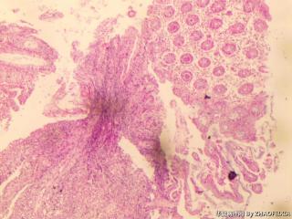 直肠组织（肠镜活检）图2