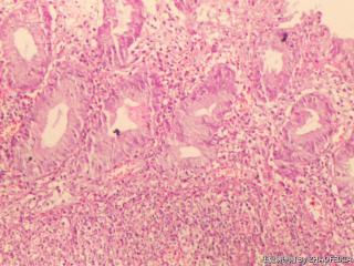 直肠组织（肠镜活检）图7