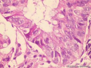 直肠活检组织图6