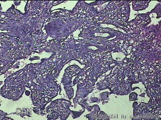 胎盘、脐带组织图33