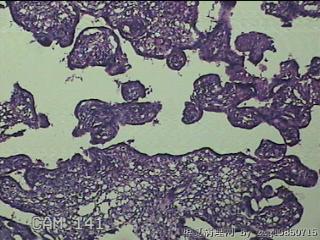 胎盘、脐带组织图35