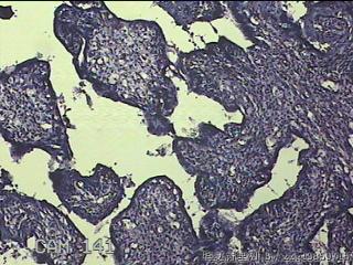 胎盘、脐带组织图45