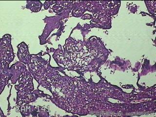 胎盘、脐带组织图30