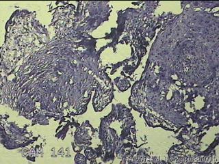 胎盘、脐带组织图36