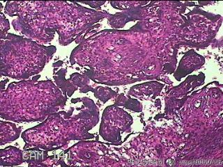 胎盘、脐带组织图8