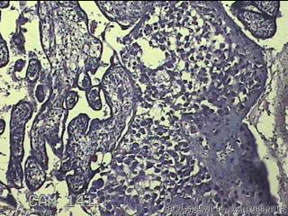 胎盘、脐带组织图44