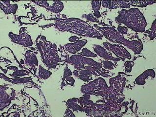 胎盘、脐带组织图17