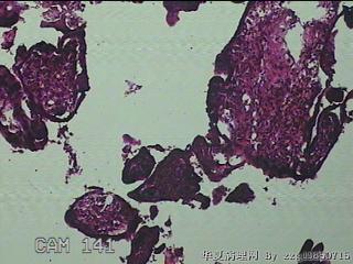 胎盘、脐带组织图11