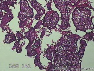 胎盘、脐带组织图27