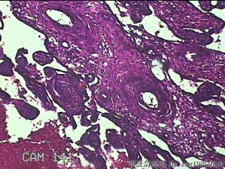 胎盘、脐带组织图39