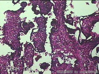 胎盘、脐带组织图15