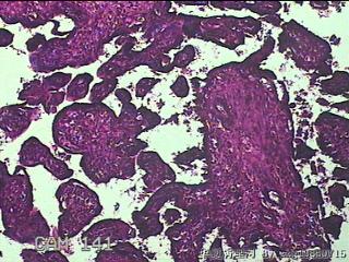 胎盘、脐带组织图38