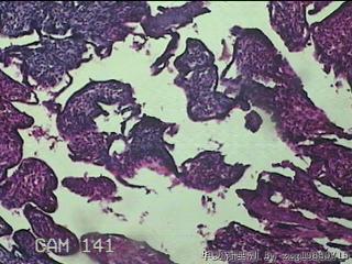 胎盘、脐带组织图40