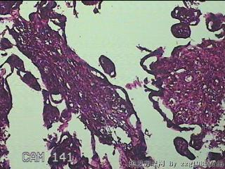 胎盘、脐带组织图5