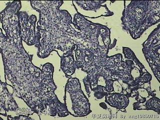 胎盘、脐带组织图42