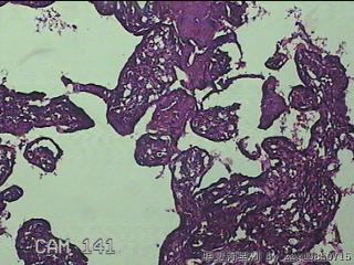 胎盘、脐带组织图31