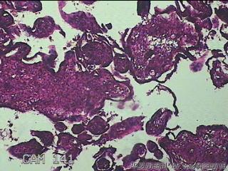 胎盘、脐带组织图4