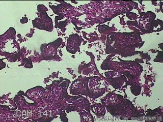 胎盘、脐带组织图13