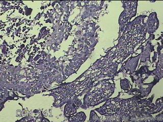 胎盘、脐带组织图34