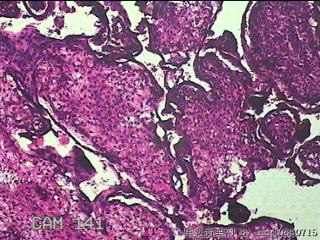 胎盘、脐带组织图9