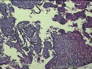 胎盘、脐带组织图18