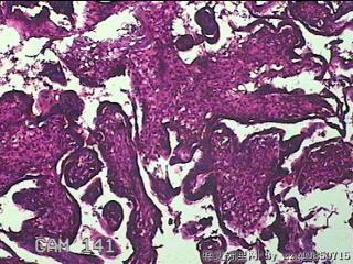 胎盘、脐带组织图2