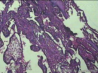 胎盘、脐带组织图32
