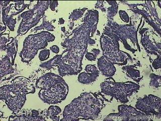 胎盘、脐带组织图19